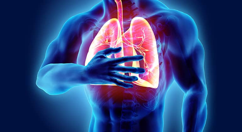 Lung Issues Post COVID-19 – A Severe Complication | VLCC India